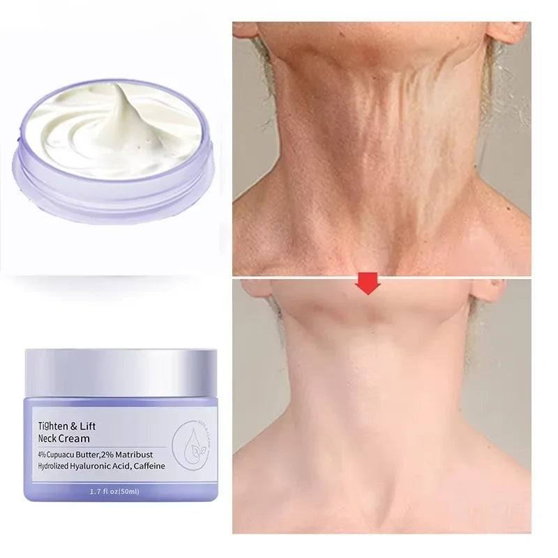 Crema Rejuvenecedora de Cuello™