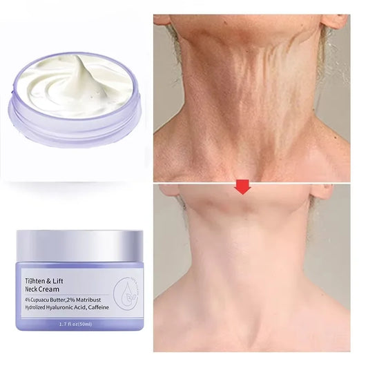 Crema Rejuvenecedora de Cuello™