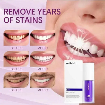 Unleash Your Confidence with a Radiant Smile!
