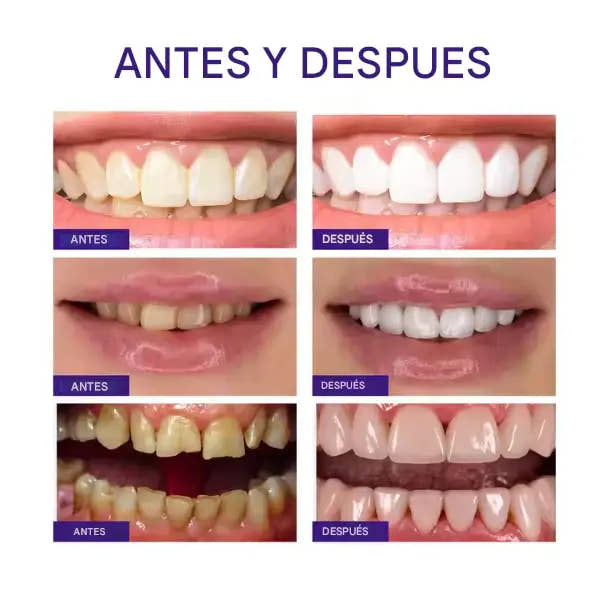 Pasta de Dientes Brillo Radiante™