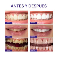 Pasta de Dientes Brillo Radiante™
